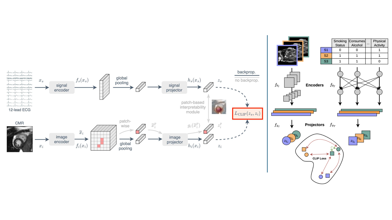 We are developing multi-modal AI algorithms that can incorporate multiple modalities and sources of information. For example, the methods shown here leverage ECG and tabular data alongside cardiac MRI to improve cardiovascular analysis. © 